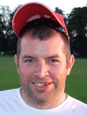 Baz loses some teeth